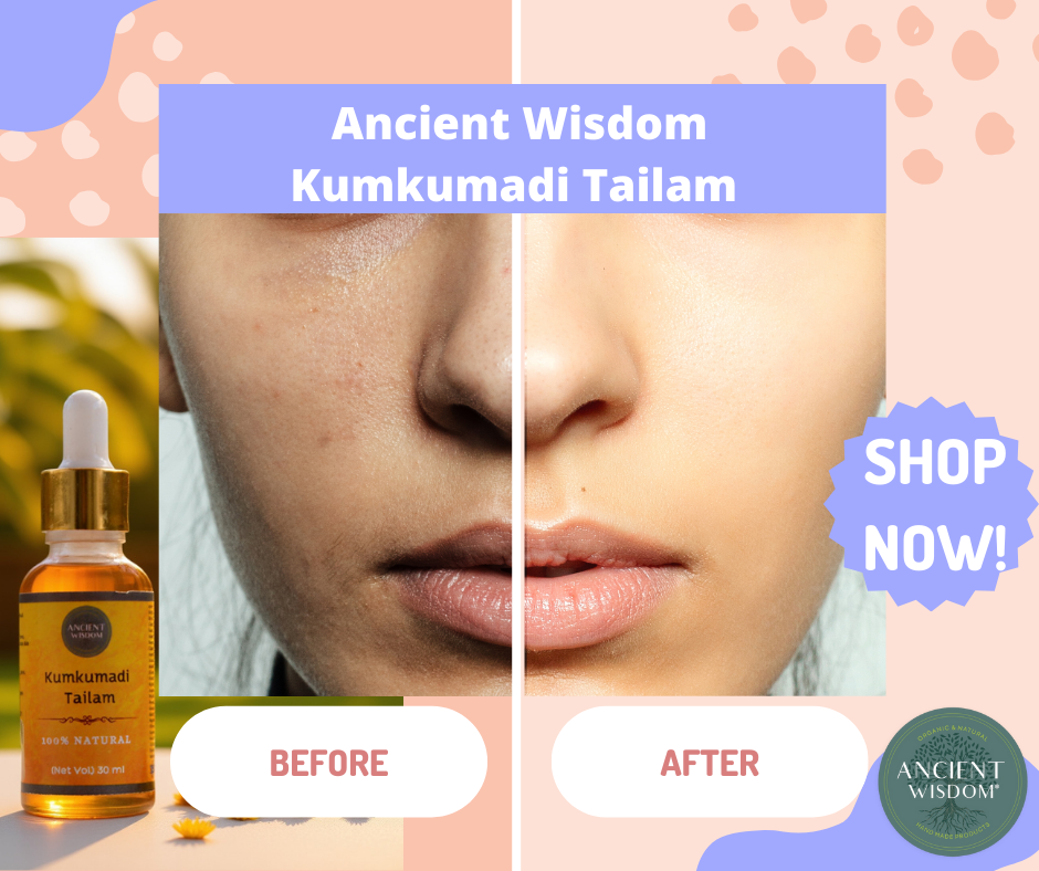 kumkumadi tailam – 30 ml kumkumadi tailam – 30 ml